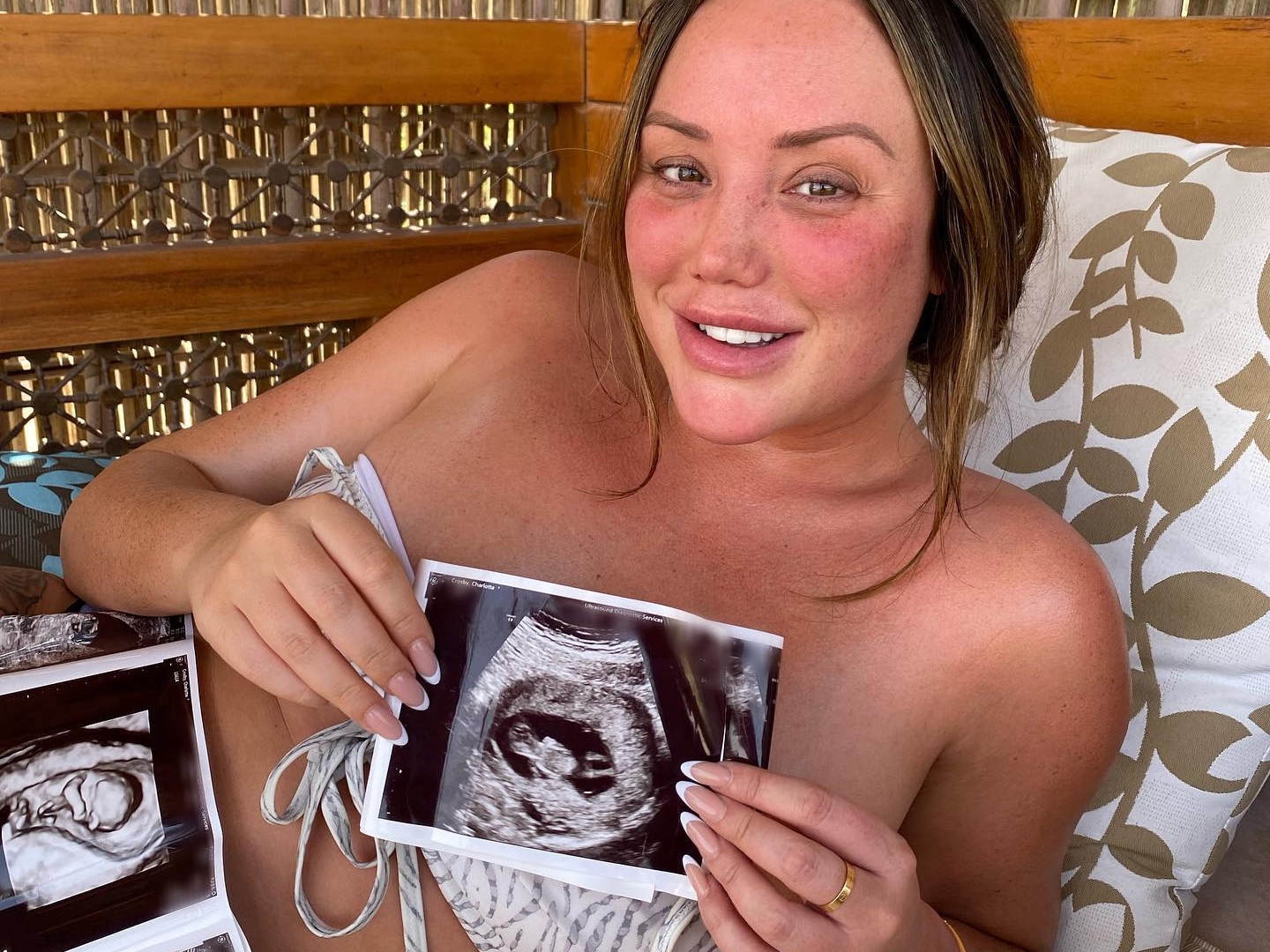 Charlotte Crosby opens up on 'high-risk' pregnancy as she gushes over scans