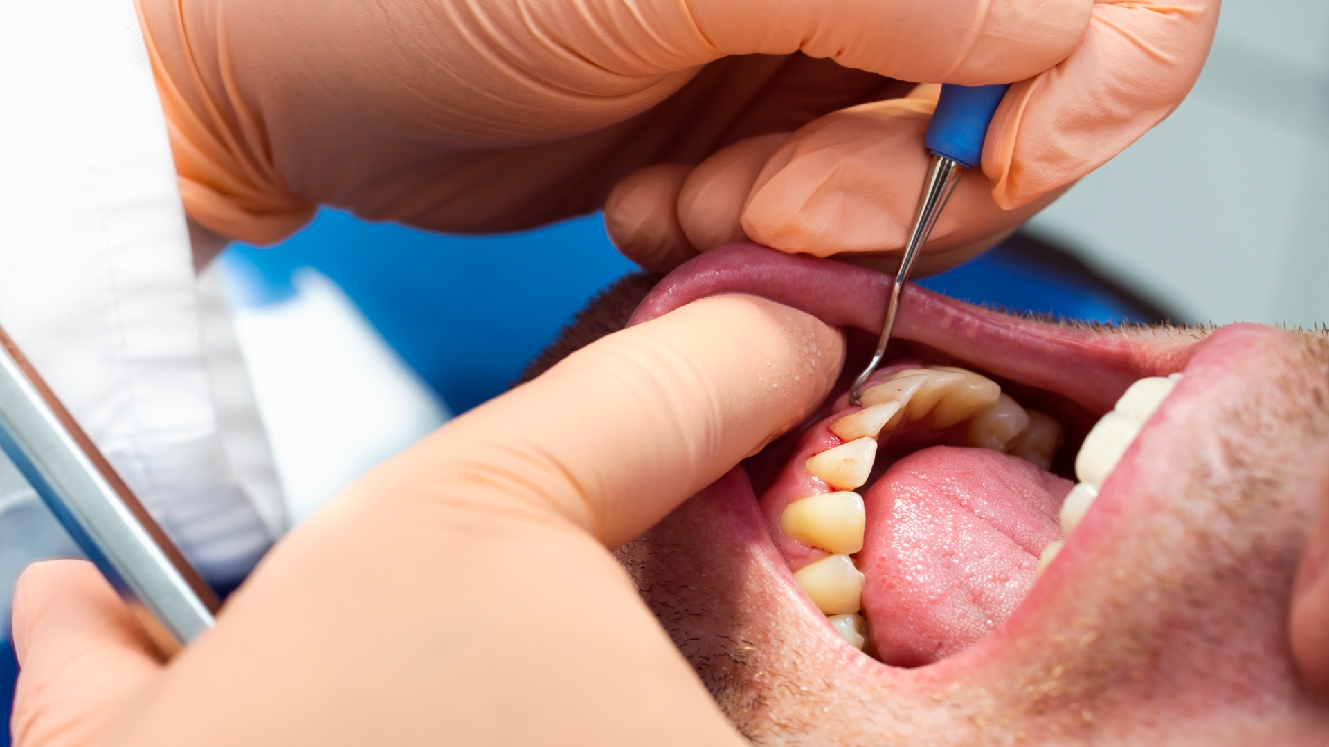 I'm a dentist - here's 5 things your mouth says about you & when to see a doctor